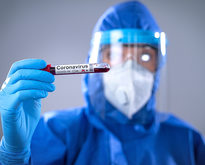 Egressos de Biomedicina da Escola de Saúde atuam no processamento dos testes Covid-19 na Unisinos