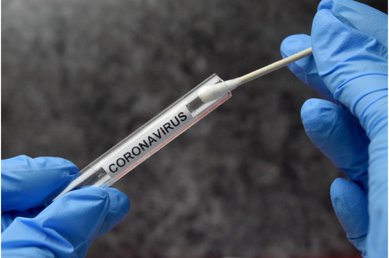 PPG em Saúde coletiva participa de nova etapa de testes para o coronavírus