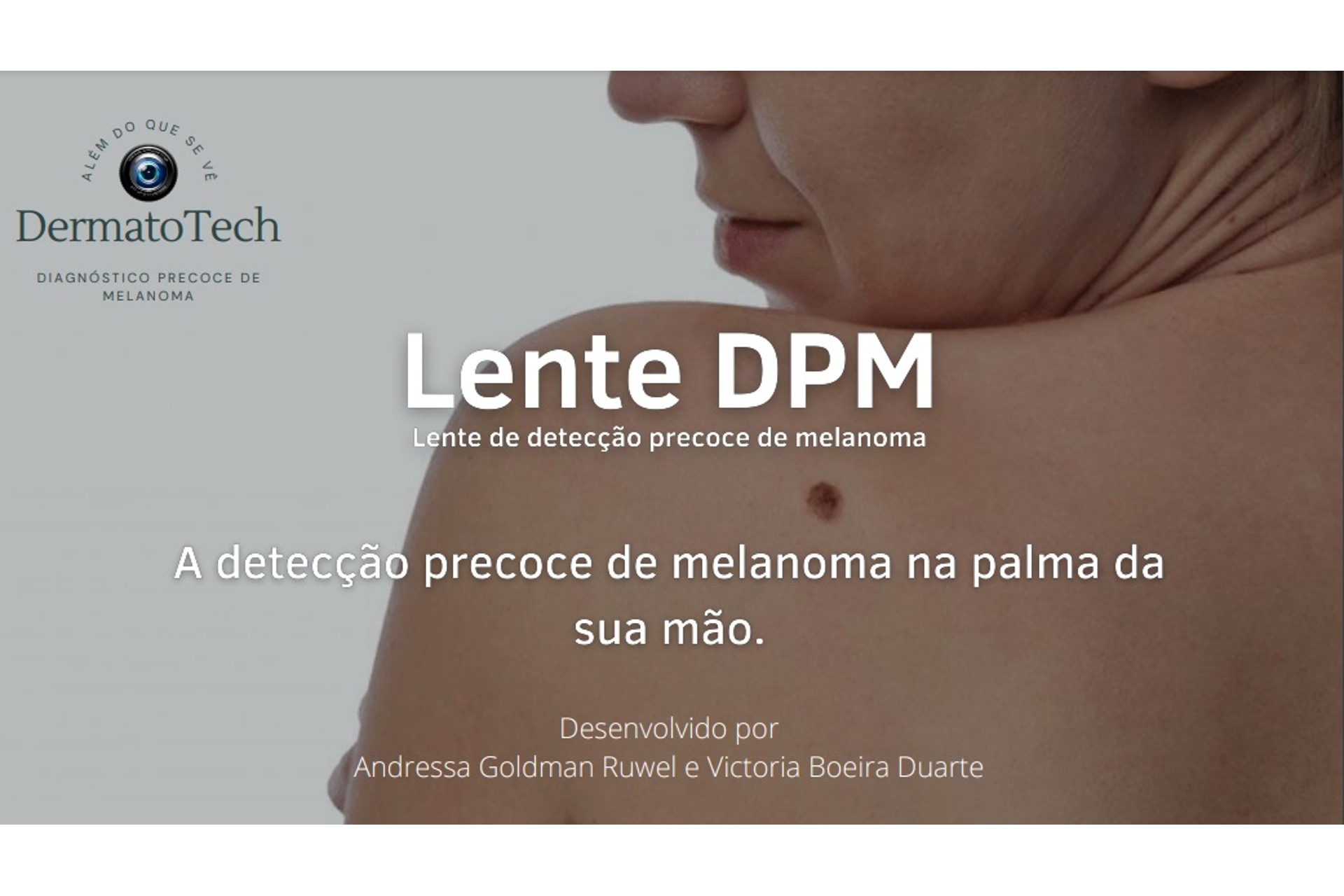 Lente DPM é destaque no Prêmio Roser
